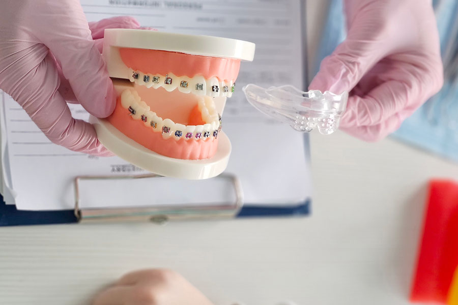 マウスピースとワイヤー矯正