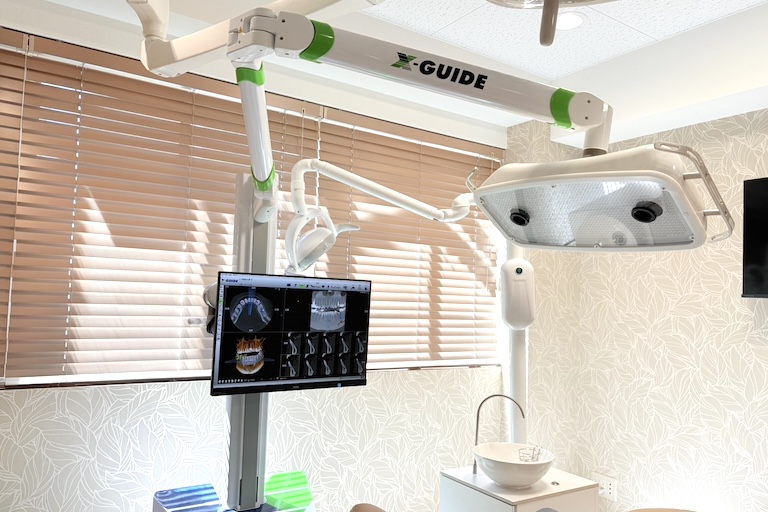 X-ガイド (3Dナビゲーションシステム)